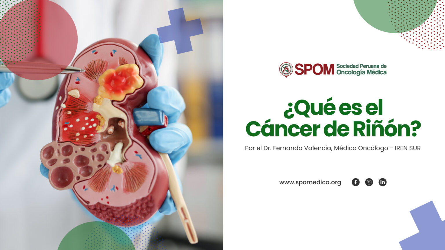 ¿Qué es el Cáncer de Riñón? - SPOM